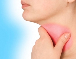 sore-throat315x244