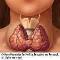Thyroid_goiternormal