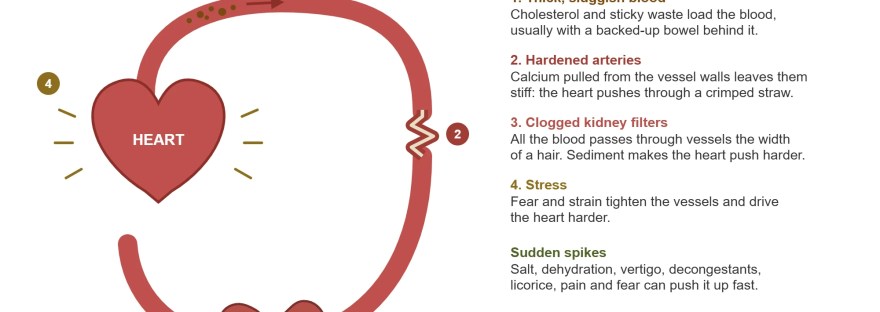 Diagram of the four causes that drive blood pressure up: thick blood, hardened arteries, clogged kidney filters and stress.