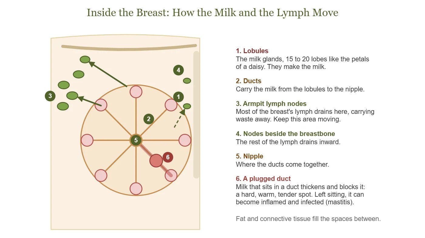 Diagram of the inside of the breast showing the lobules, ducts, nipple, lymph nodes and a plugged duct.