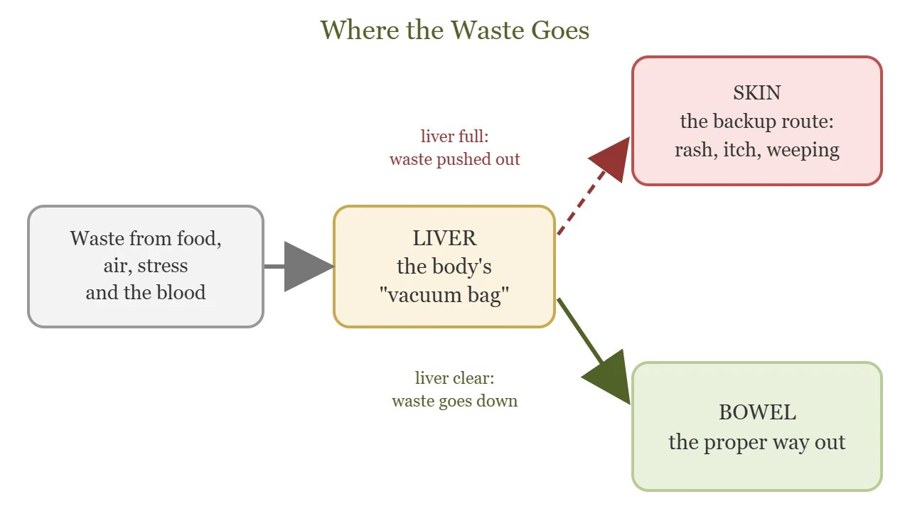Diagram: when the liver is clear its waste goes down to the bowel; when it is full the waste is pushed out through the skin