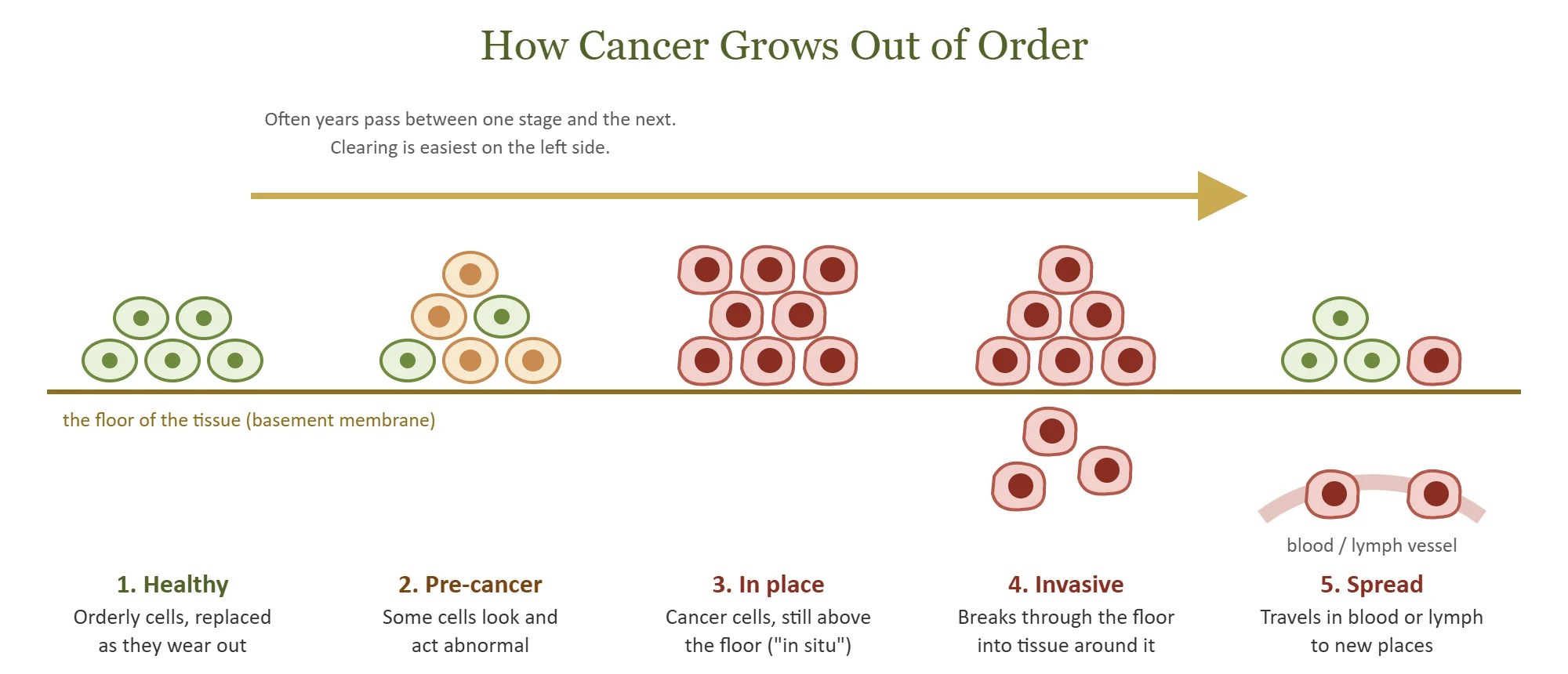 How cancer grows out of order, from healthy cells to spread