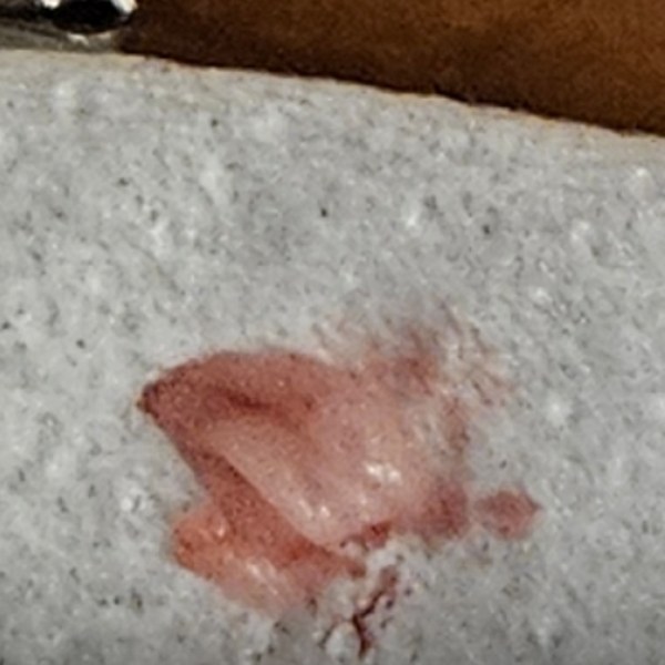 The solid mass that came out, on a paper towel