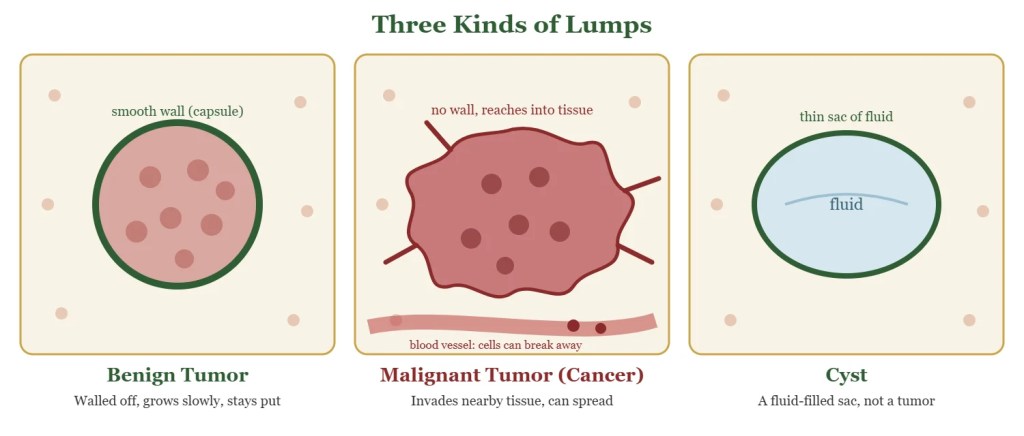 Diagram comparing a benign tumor, a malignant tumor and a cyst.